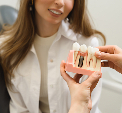 Impianti Dentali